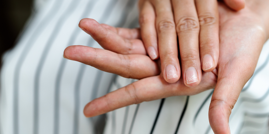 Main Causes of Brittle Nails